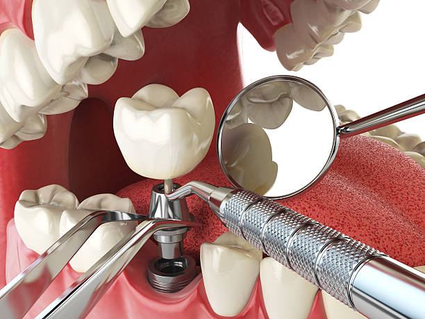 Best Weekend Emergency Dentist in Maurice, LA